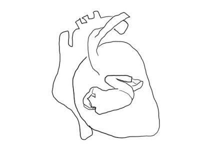 Die Nebenwirkungen der&nbsp;Angst